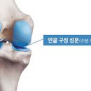연골 이미지