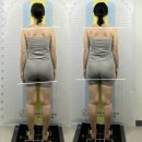 5761 | 대전안면비대칭 관리는 '라움리포벨 안면비대칭연구소' 에서! 솔직후기