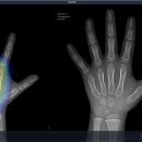 베데스다의료기 이미지