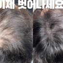 픽스칼프