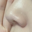 (주)논현메드 | 기록을 위해 남기는 눈코 성형 발품 및 상담 내용