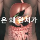 췌장암은 왜 완치가 힘들까. 이미지