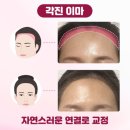 이미지헤어라인 이미지