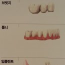 미시건치과 이미지