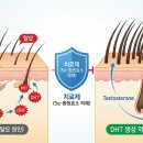 코스맥스파마(주) | 남성형 탈모 약 비교, 프로페시아 vs 아보다트