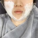 비오페이스의원 | BIOFACE피부과 _ 브이슈링크, 리프톡스, 턱보톡스, 리프테라통증과 찐후기 (내돈내산)