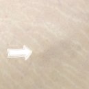 스킨52부천지부 이미지