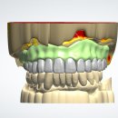 최신심미치과기공소 이미지