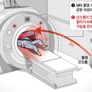 MRI 찍다 '날벼락'.. 빨려든 산소통에 환자 숨져 이미지