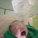 여성아이병원 | 대구 여성아이병원 제왕절개 출산후기 / 1인실 입원 비용 , 주의사항