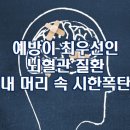 예방이 최우선인 뇌혈관 질환 내 머리 속 시한 폭탄 이미지