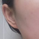 라파메디케어 이미지