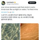 누군가 내 튼살을 물에 비친 햇살과 같다고 말한 이후로 나는 내 튼살을 좋아하게 됐어요 이미지