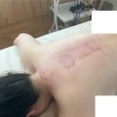 기노뷰티살롱 | 온천장피부관리 기노뷰티살롱 에너지테라피 등관리 후기