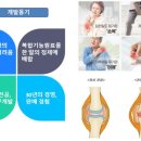 관절나라 네이버블로그