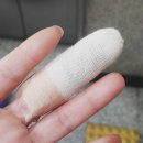 . | 손가락 관절염 콘드로이친 효능 후기