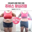 청량리한의원 | 청량리 헬스장 안가도 돼, 난 누워서 -42kg 성공!