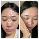 나이스메디칼 | 클리어비 클렌징타올 페이스 여드름 패드 티슈 1박2일 여행준비물 추천