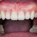 수성치과기공소 이미지