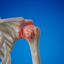 삼성센텀정형외과의원 이미지