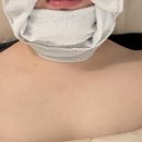 엘마르 | 천안 웨딩관리 불당동 엘마르에스테틱, 윤곽+데콜테 완전 만족한 솔직 후기