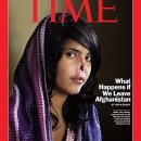 '코 없는 아프간 여인' 성형수술 받는다 이미지