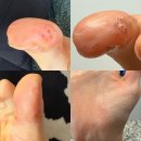 바람은 왱왱왱 마음은 잉잉잉