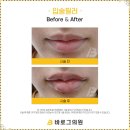 바로그의원 이미지