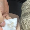 눈이야기 | 페노비스 오큐틱 눈&amp;귀세정제 후기