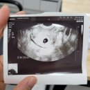진주숲어린이집 | [모두의 회고] 우리 가족 10년 이주의 역사 ② 진주에서의 숨고르기, 그리고 우리의 세 번째 도시...