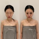 어린이대공원 제1호 화장실(남/녀) | 첨단에스테틱 에스테티아첨단1호점 윤곽관리 전후 후기