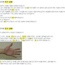 산행시 다리에 쥐가 났을때 응급처치법 이미지