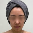 바디채널 첨단점 | 첨단에스테틱 광주에스테티아 월계동 윤곽관리 후기