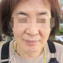 인셀덤 은평대리점 이미지