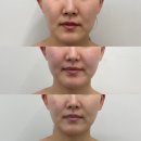 에이엠메디칼 이미지