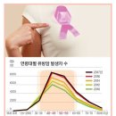 여성암 1위 유방암, 40세부터 정기 X레이 검사를 이미지