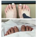 전포동 네일샵 네일비움 서면 문제성손발톱 전포 손톱교정 솔직후기 내돈내산