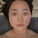 아림 에스테틱 | (새솔동) 에스테틱 단아 솔직후기 🌿 | 예비 신부 필수 코스, 새솔동 피부관리
