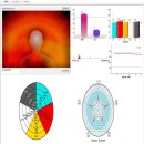 동양의료기 | 신기한 패치 와우! 동전 통증 개선 패치! 소개