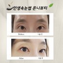 부천바른솔한방병원 | [공지] 인생 속눈썹 찾았다! 부천 신중동 속눈썹 온니뷰티 솔직 후기