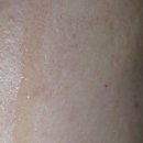 순수코스메틱 | 항산화앰플 오월의아침코스메틱 스트롱 비타민C앰플 사용후기