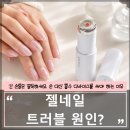 네일위크 | 젤네일 후 트러블이 반복된다면? 흡수 디바이스를 사용하는 이유 (여드름 피부)