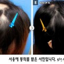 여성원한의원 네이버블로그