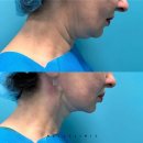 영광의원 | [IMCAS Paris 2026] 임카스 파리 강연 후기 | 넬의원 이경은 원장