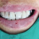 아이디치과기공소 이미지