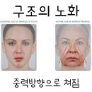 올큐어리프팅