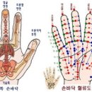 수지침 티스토리