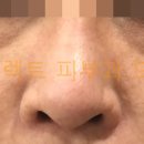 셀렉트피부과의원 네이버블로그