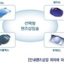 누네안경 이미지