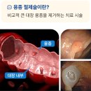 김화내과 네이버블로그